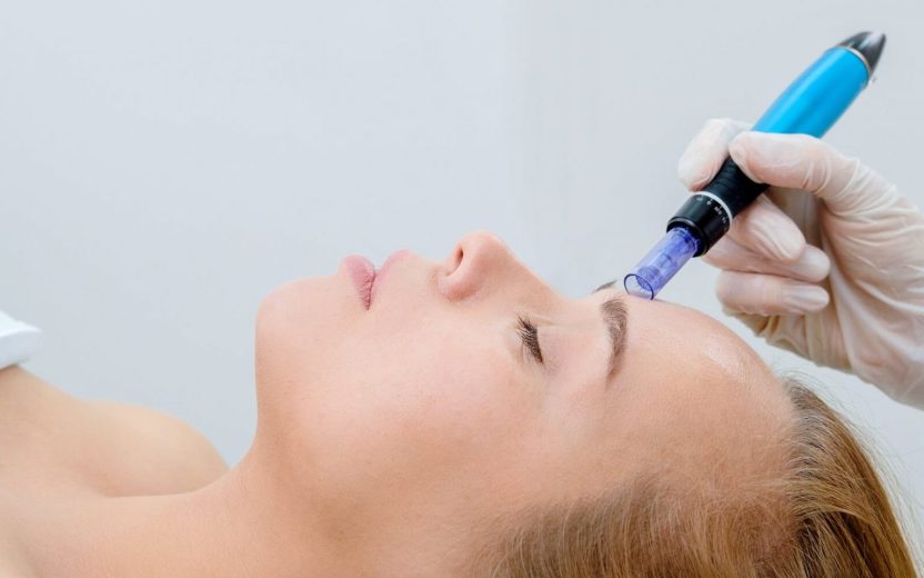 skin needling melbourne
